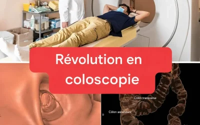 Nouvelle méthode : la coloscopie ne sera plus un examen invasif.(1/2)